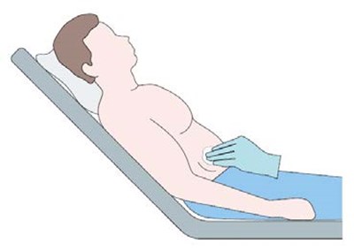 Step 2 (Step 2)